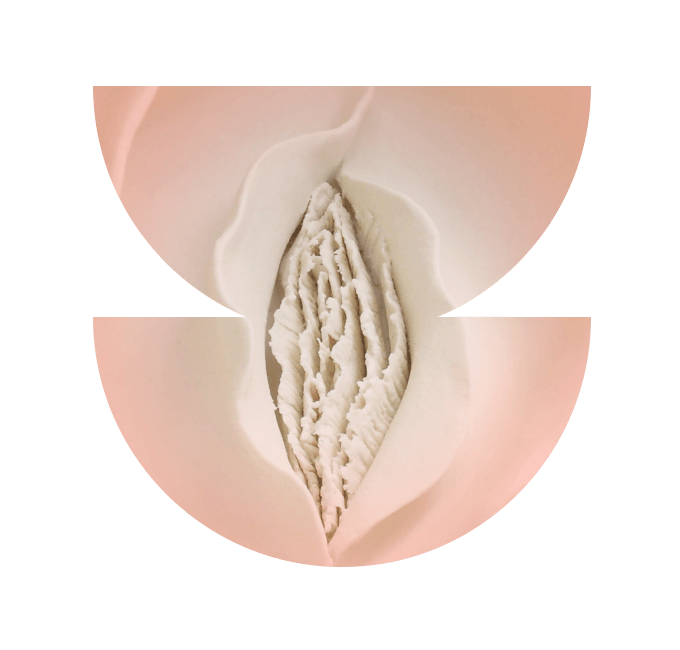 vaginal restoration